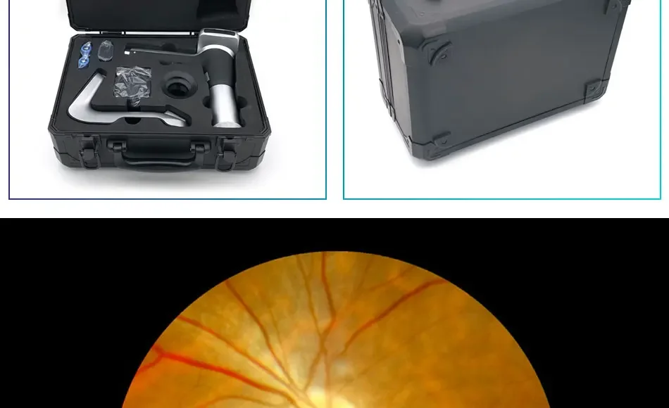 HFC-2 Portable Mydriatic Handheld Digital Second Generation Autofocus Fundus Camera Optical Ophthalmology Medical Instruments
